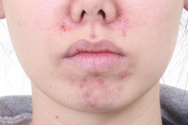 부산재교정치과