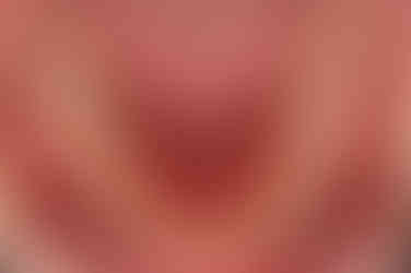 부산치아교정잘하는곳