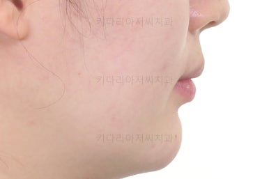 부산인비절라인