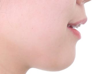 부산연산동교정치과