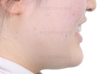 부산치아교정