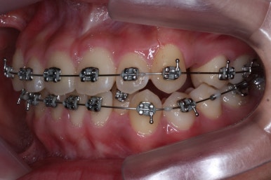 부산교정전문의