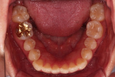 부산인비절라인