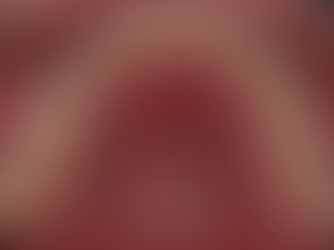 연산동사랑니치과