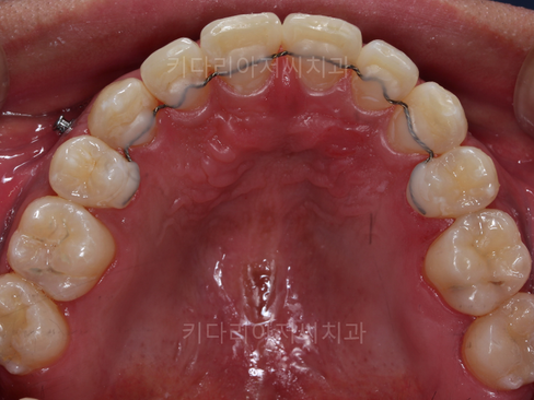연산동사랑니치과