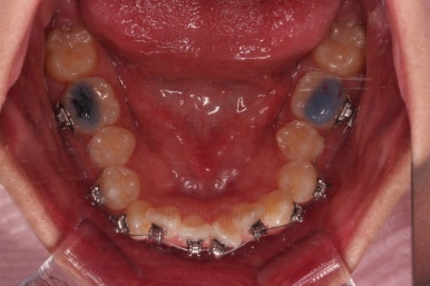 연산동치아교정치과