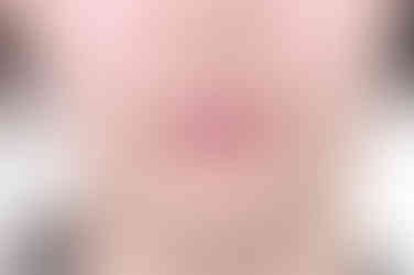 부산부분치아교정