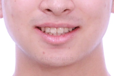 부산교정치과추천