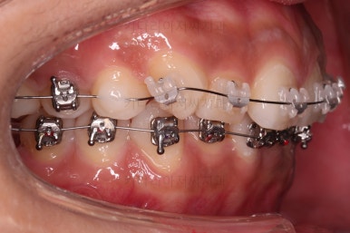 연산동교정치과