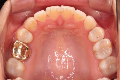 부산인비절라인