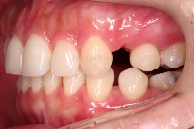 부산인비절라인