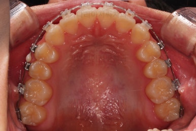 부산교정전문의