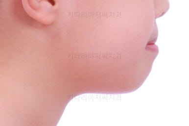 부산어린이교정