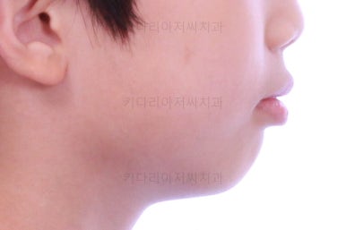 부산어린이교정