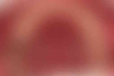 연산동임플란트