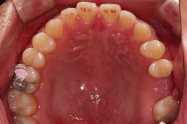 연산동임플란트
