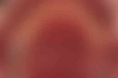 연산동임플란트