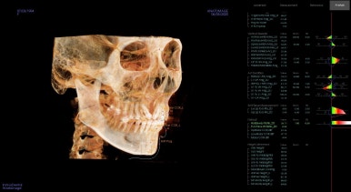 부산구순구개열