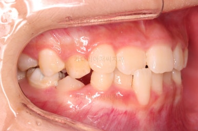 부산어린이교정