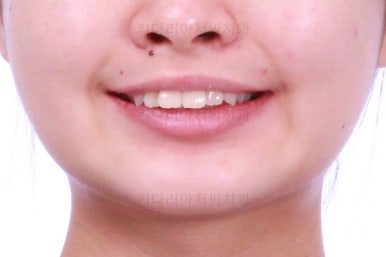 부산치아교정치과