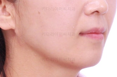 부산인비절라인