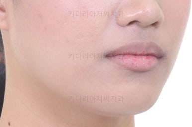 연산동치아교정치과