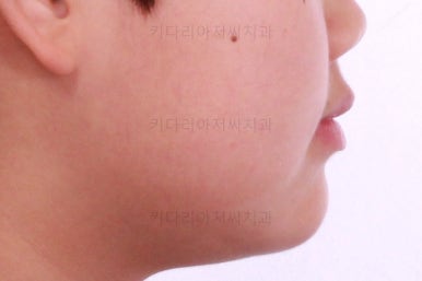 부산교정치과추천