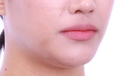 연산동치아교정치과