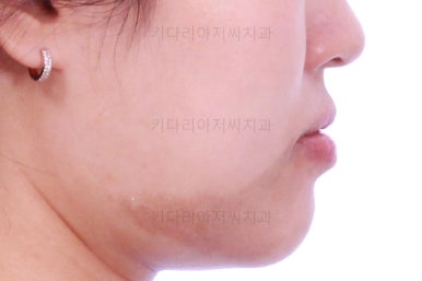 부산치아교정잘하는곳