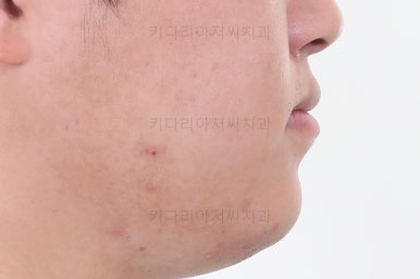 연산동교정