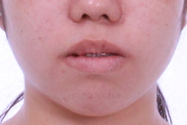 부산교정전문치과