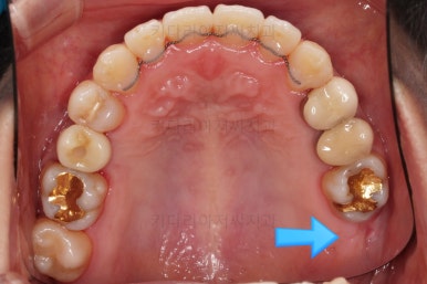 부산연산동치과
