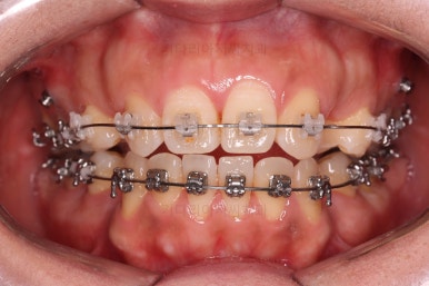 연산동교정치과