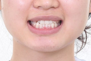 부산교정