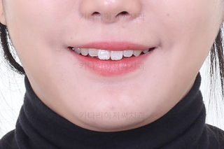 부산치아교정