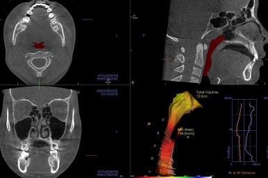 부산치아교정잘하는곳