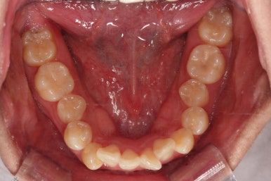 연산동치아교정치과