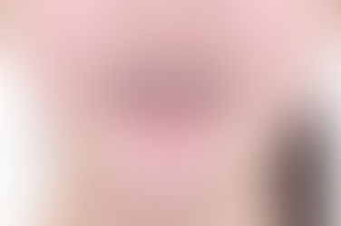 부산덧니교정