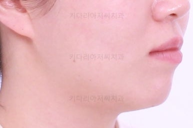 부산치아교정잘하는곳