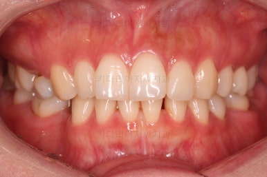 부산인비절라인