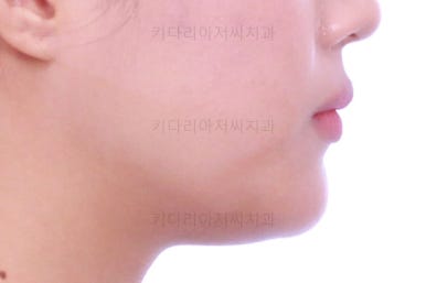 연산동치아교정치과