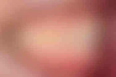 연산동임플란트