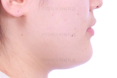 부산치아교정