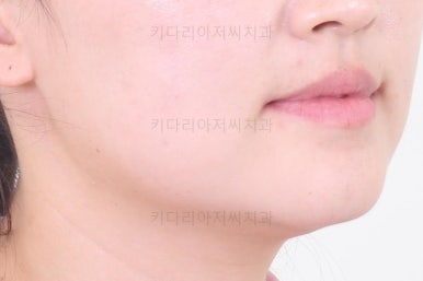 연산동교정치과