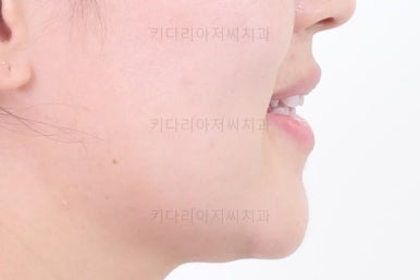 연산동교정치과