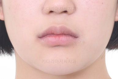 사직동교정치과