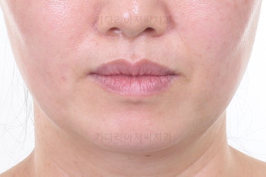 부산치아교정잘하는곳