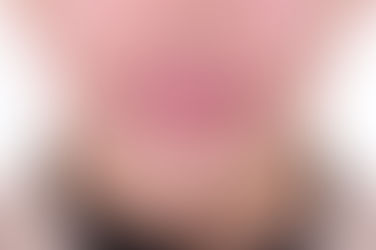 부산교정과전문의