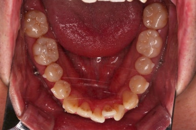 부산인비절라인