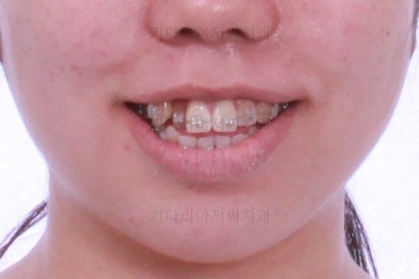 부산교정전문치과